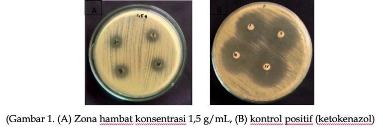 Zona hambat Ekstrak M.furfur terhadap fungi